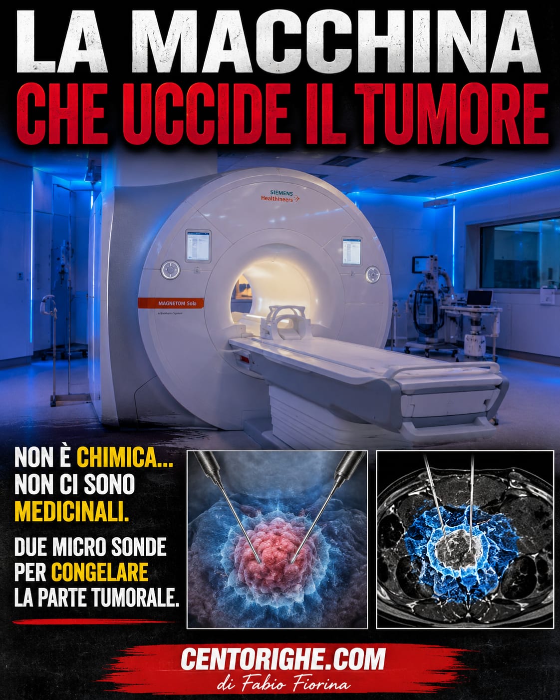  Congelare il tumore