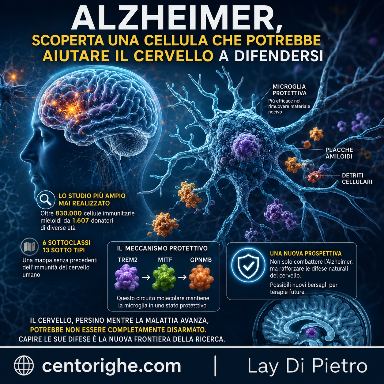 Alzheimer